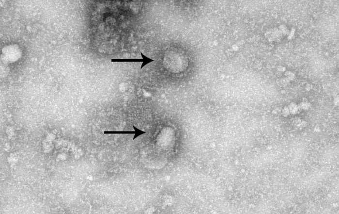 Researchers Are Racing to Make a Coronavirus Vaccine
