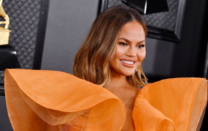 Chrissy Teigen Is Getting Botox While Pregnant—Here’s Why