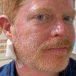 Jesse Tyler Ferguson Reveals He Had a ‘Bit of Skin Cancer’ Removed