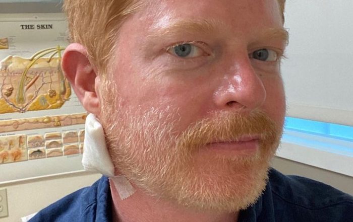 Jesse Tyler Ferguson Reveals He Had a ‘Bit of Skin Cancer’ Removed