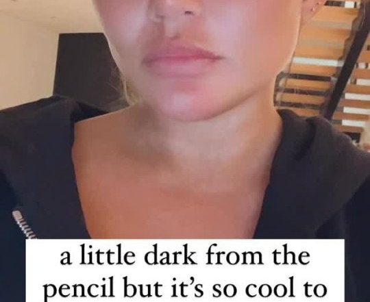 Chrissy Teigen’s ‘Eyebrow Transplant’ Results Are Actually Pretty Dramatic