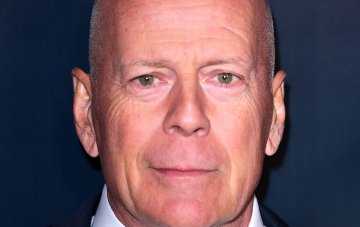 This Condition Has Prompted Bruce Willis to Step Away From Acting